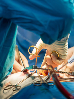 Kidney Surgery in Guntur