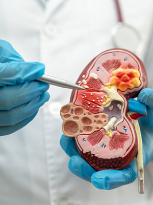 nephrologist in guntur